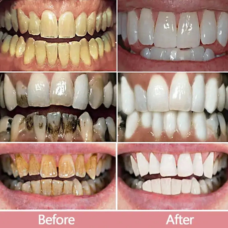 V34 Pro Smile Whitening Toothpaste